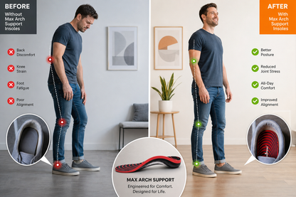 Max Arch Support Insoles